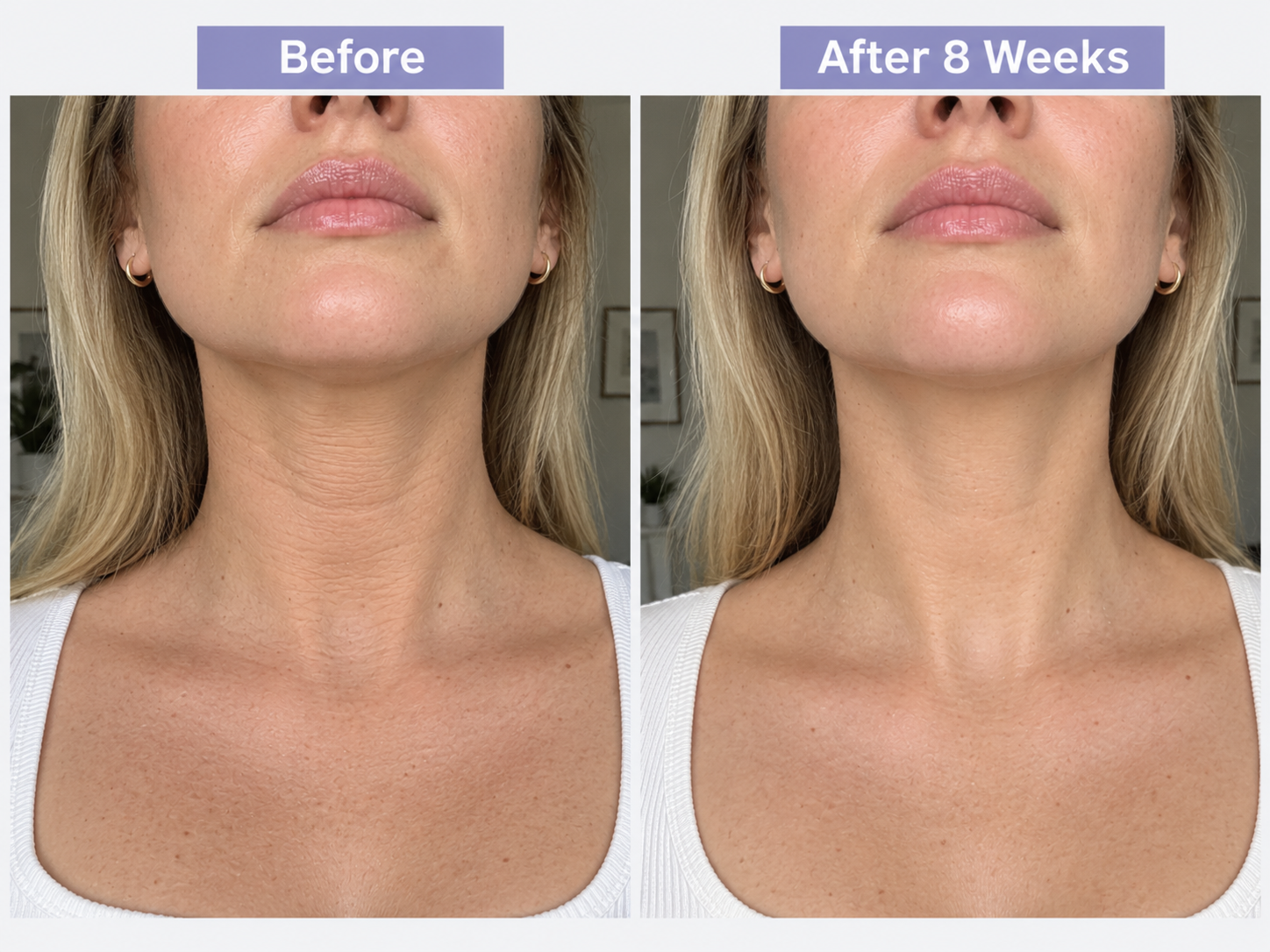 DERMATURA Tighten & Lift Neck Cream